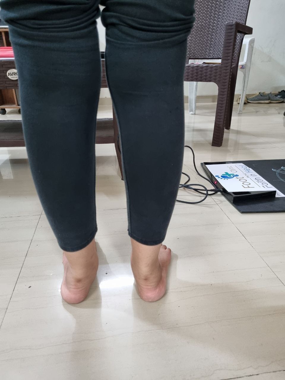 Foot Pronation